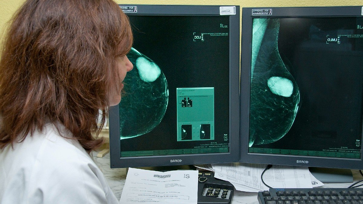 El programa de detección precoz de cáncer de mama tiene un alto grado de participación en Castilla-La Mancha. - J.J. RAMOS / SESCAM